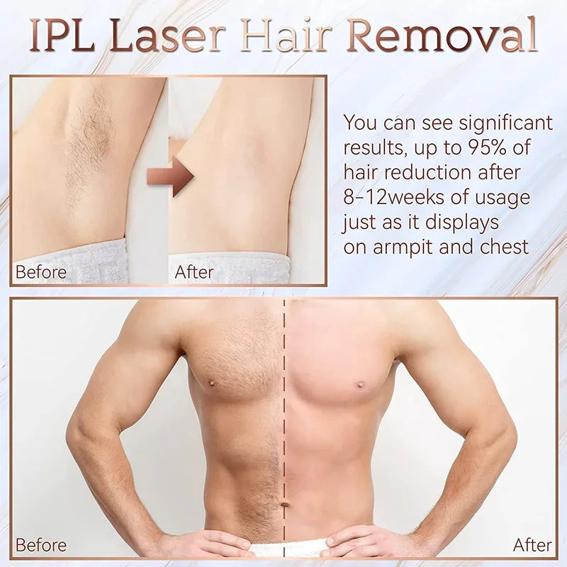 Épilateur laser indolore pour femme et homme, corps, bikini, IPL 999,999 flashs, pulsations en continu, épil