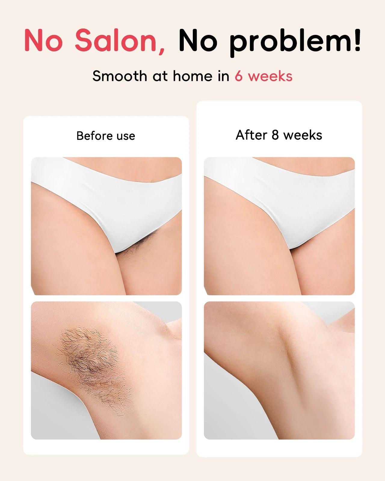 Épilateur laser IPL pour hommes et femmes,